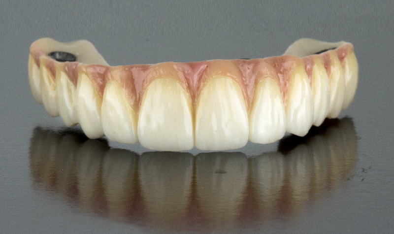 Rehabilitación oral completa Clínica Vallegrande