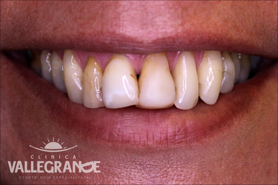 título de fotografia para caso clínico