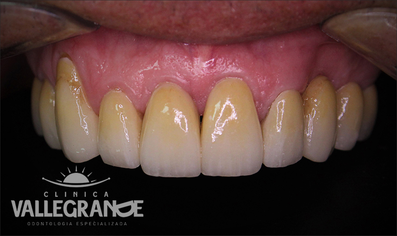 título de fotografia para caso clínico