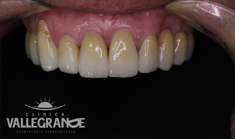 título de fotografia para caso clínico