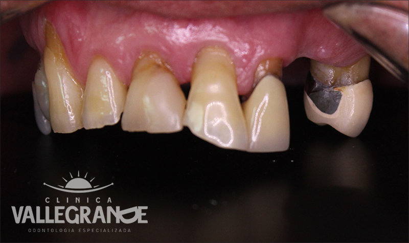 título de fotografia para caso clínico