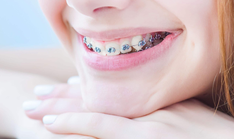 Endodoncia Clínica Vallegrande